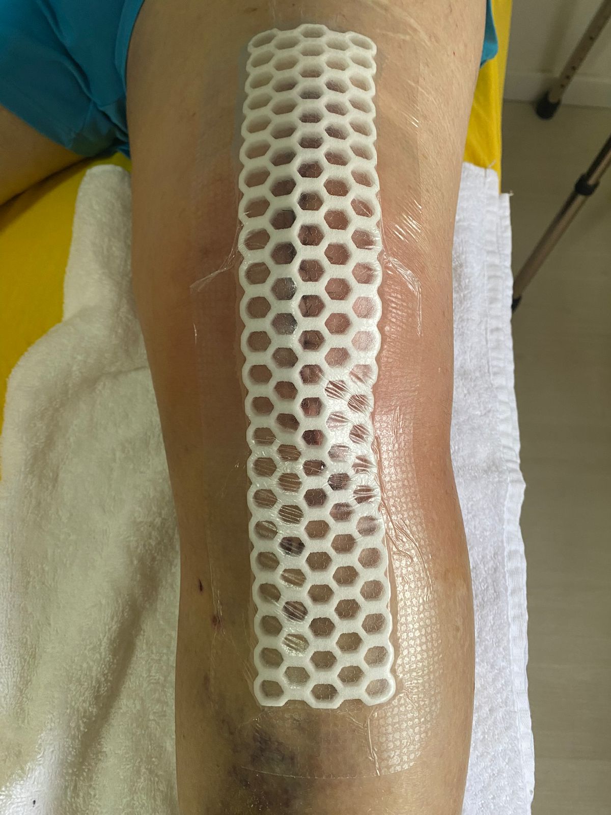 Galeria Curativos especializados