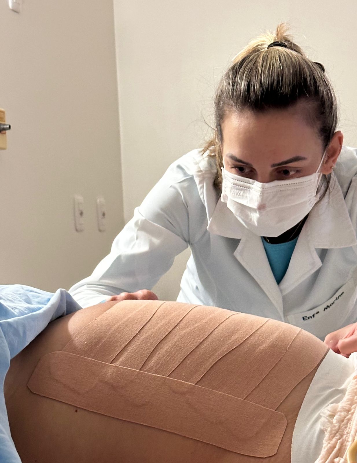 Galeria Taping pós-parto